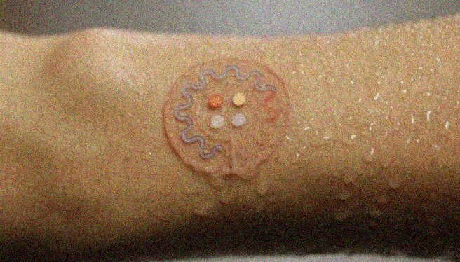 Wearable medico cortisolo sudore