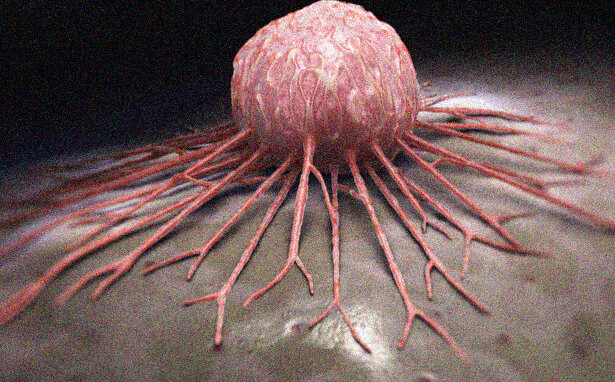 Cancro alla cervice uterina, il vaccino più promettente è realtà