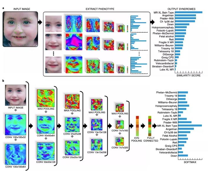 Intelligenza artificiale e riconoscimento facciale usate per identificare rare patologie genetiche 1