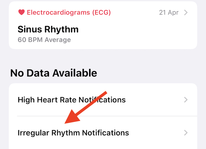 iphone notifiche apple watch ritmo cardiaco irregolare