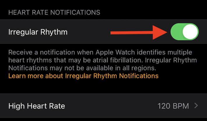notifiche apple watch ritmo cardiaco irregolare