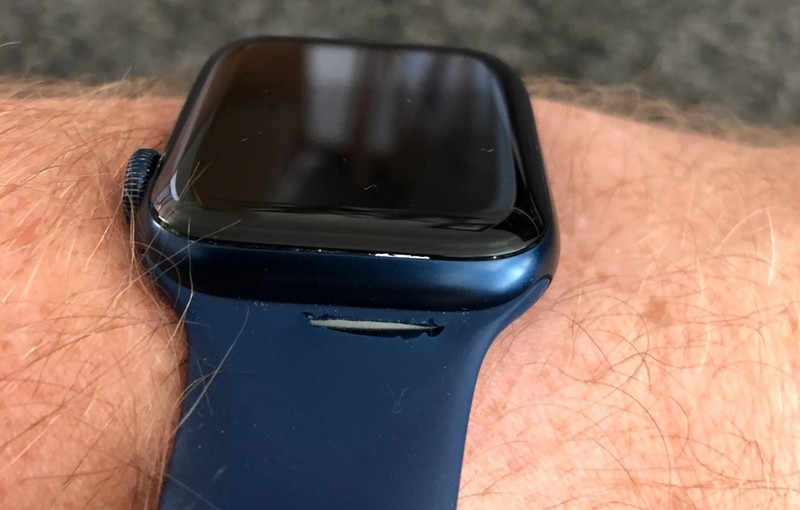 Apple Watch Solo Loop
