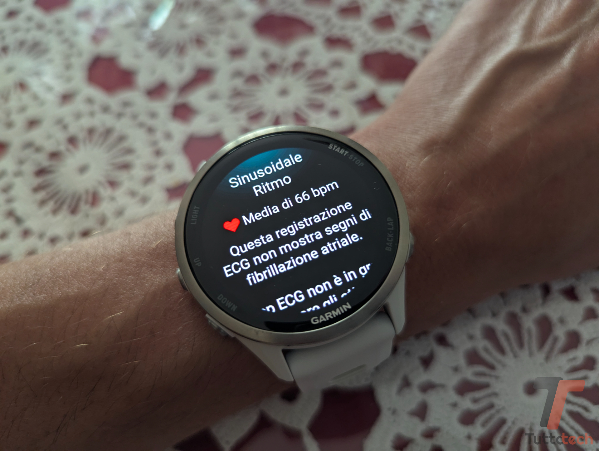 Risultati app ECG - Recensione Garmin Forerunner 970