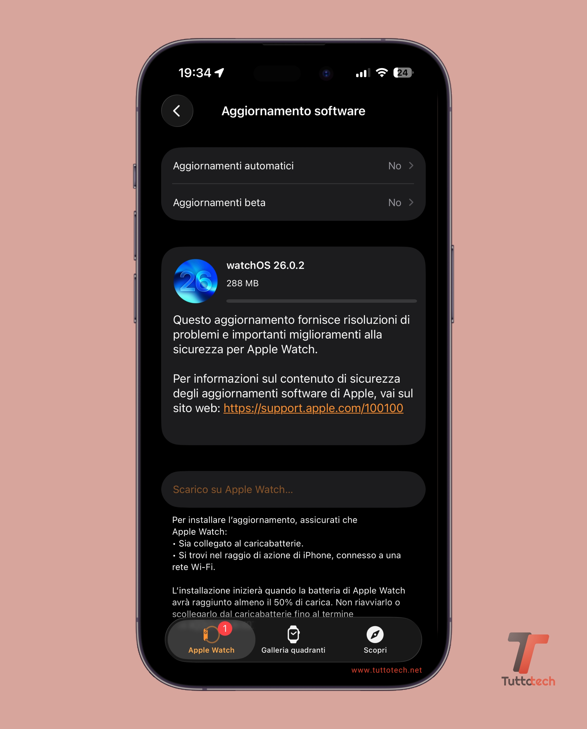 watchOS 26.0.2 on Apple Watch Series 10