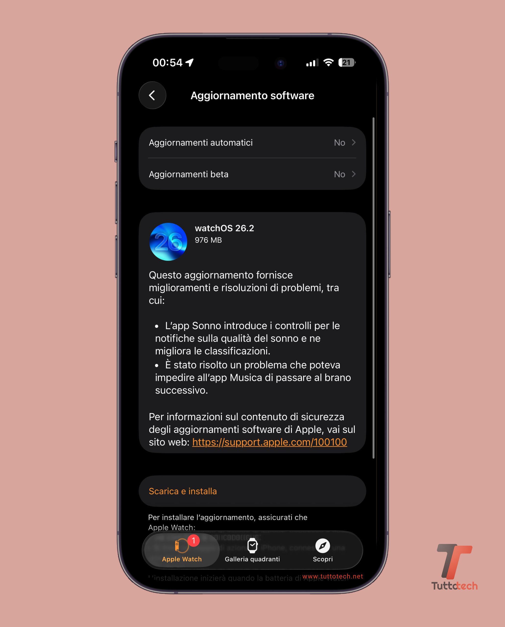 watchOS 26.2 on Apple Watch Series 10