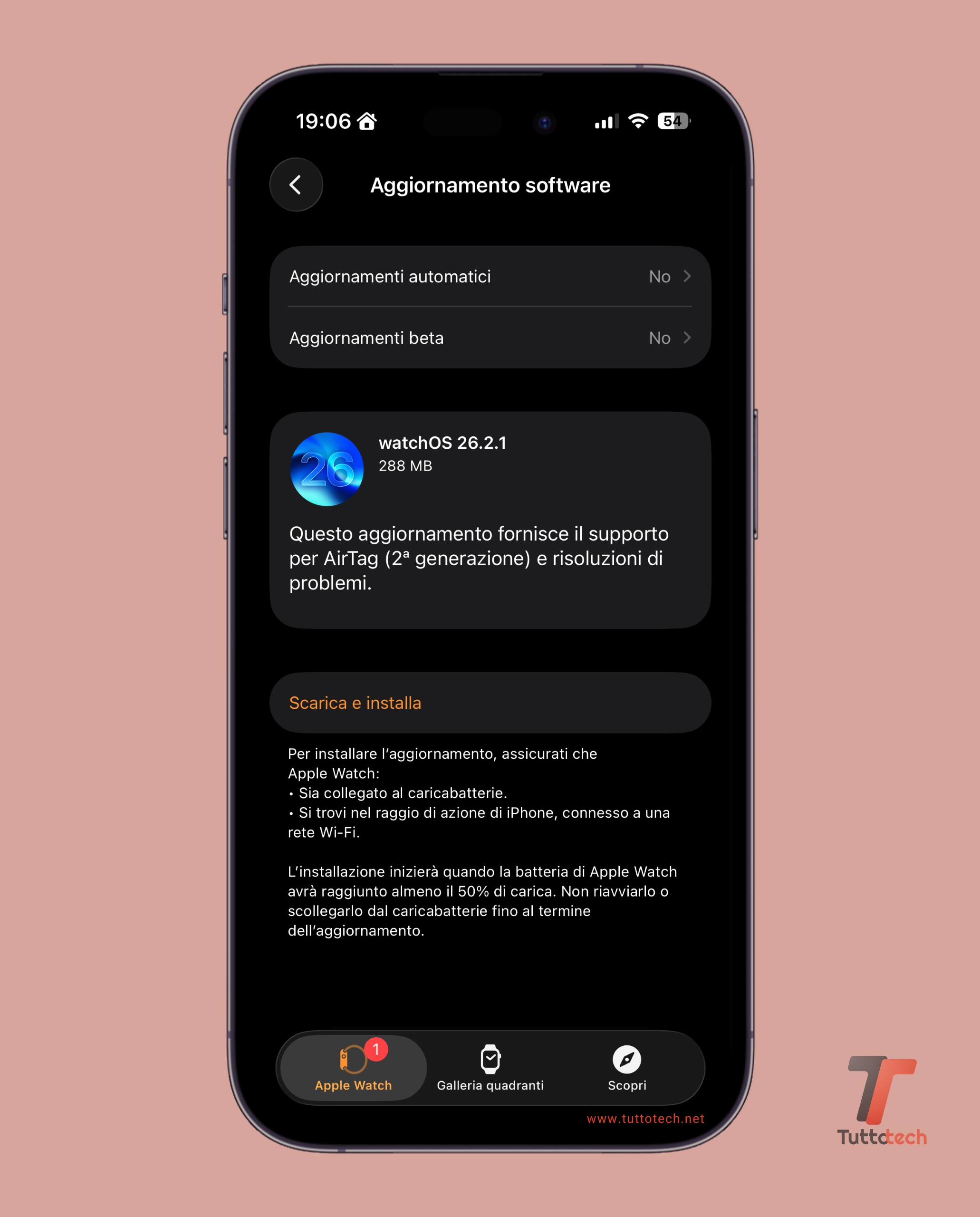 watchOS 26.2.1 on Apple Watch Series 10