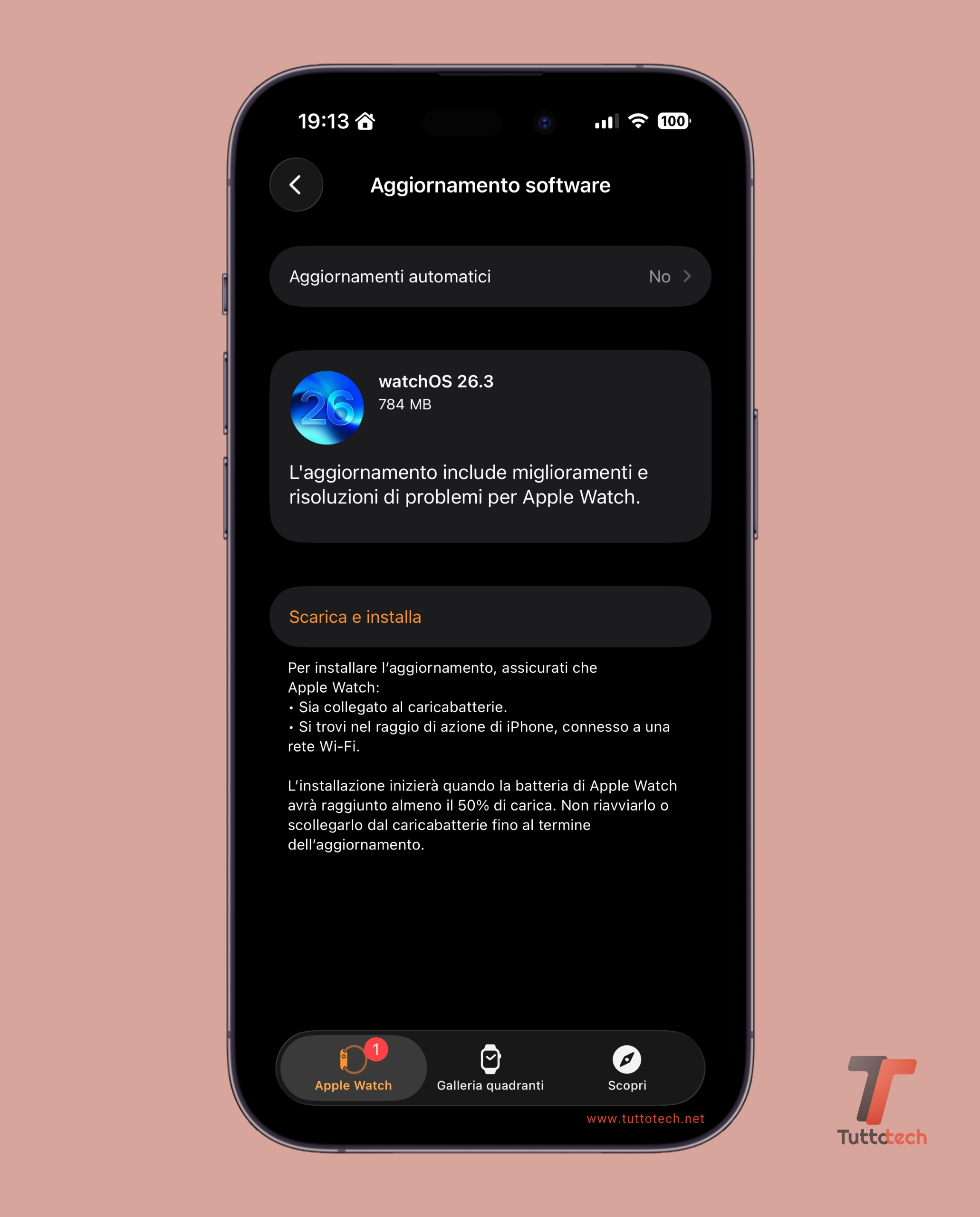 watchOS 26.3 on Apple Watch Series 10