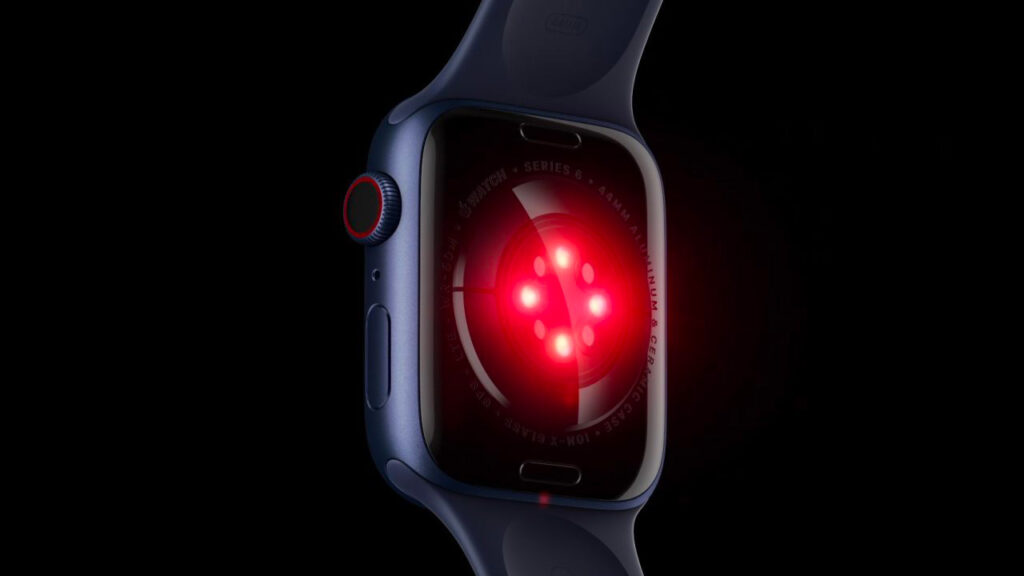 Apple Watch Series